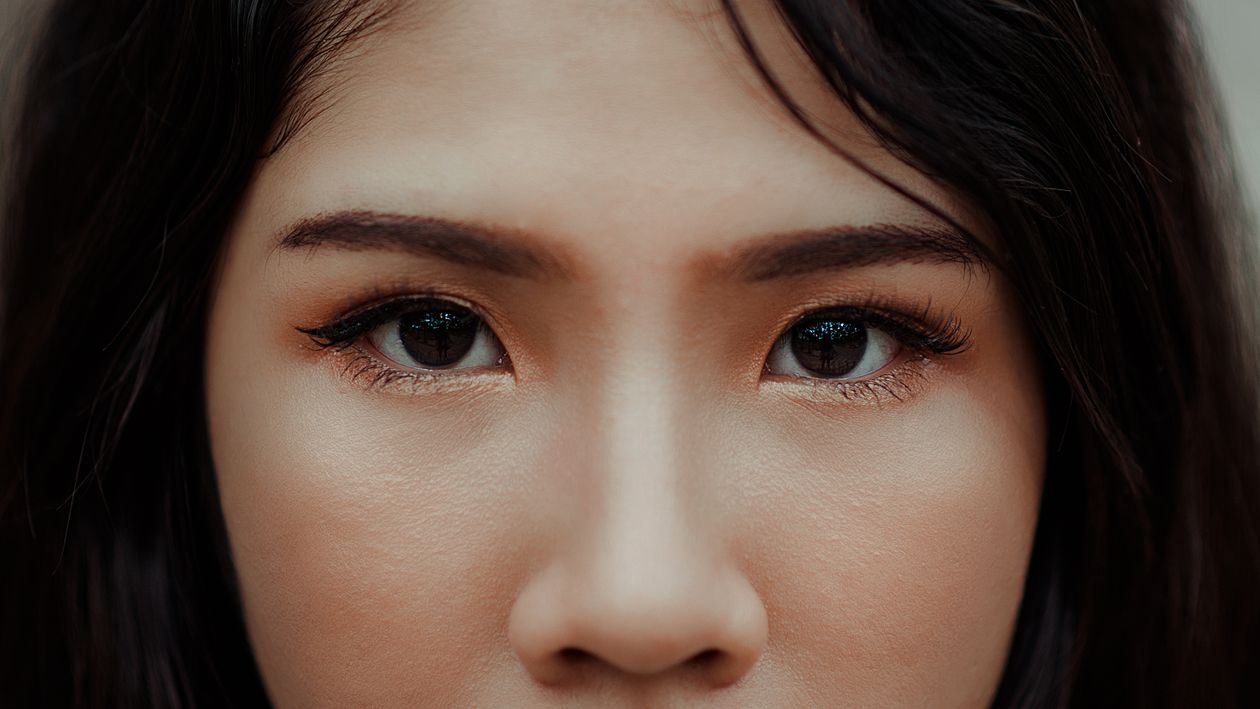 a girl having eye bags