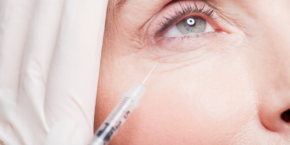 Dermal Fillers for Tear Trough Shadows