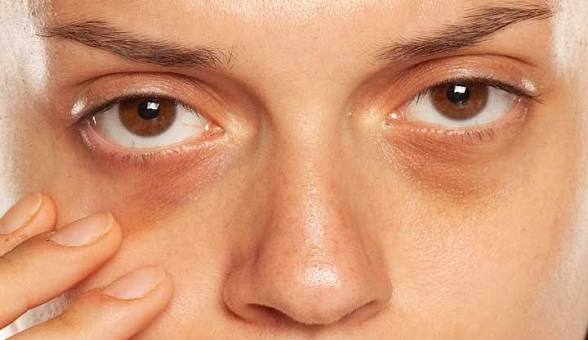 Structural Dark Circles 