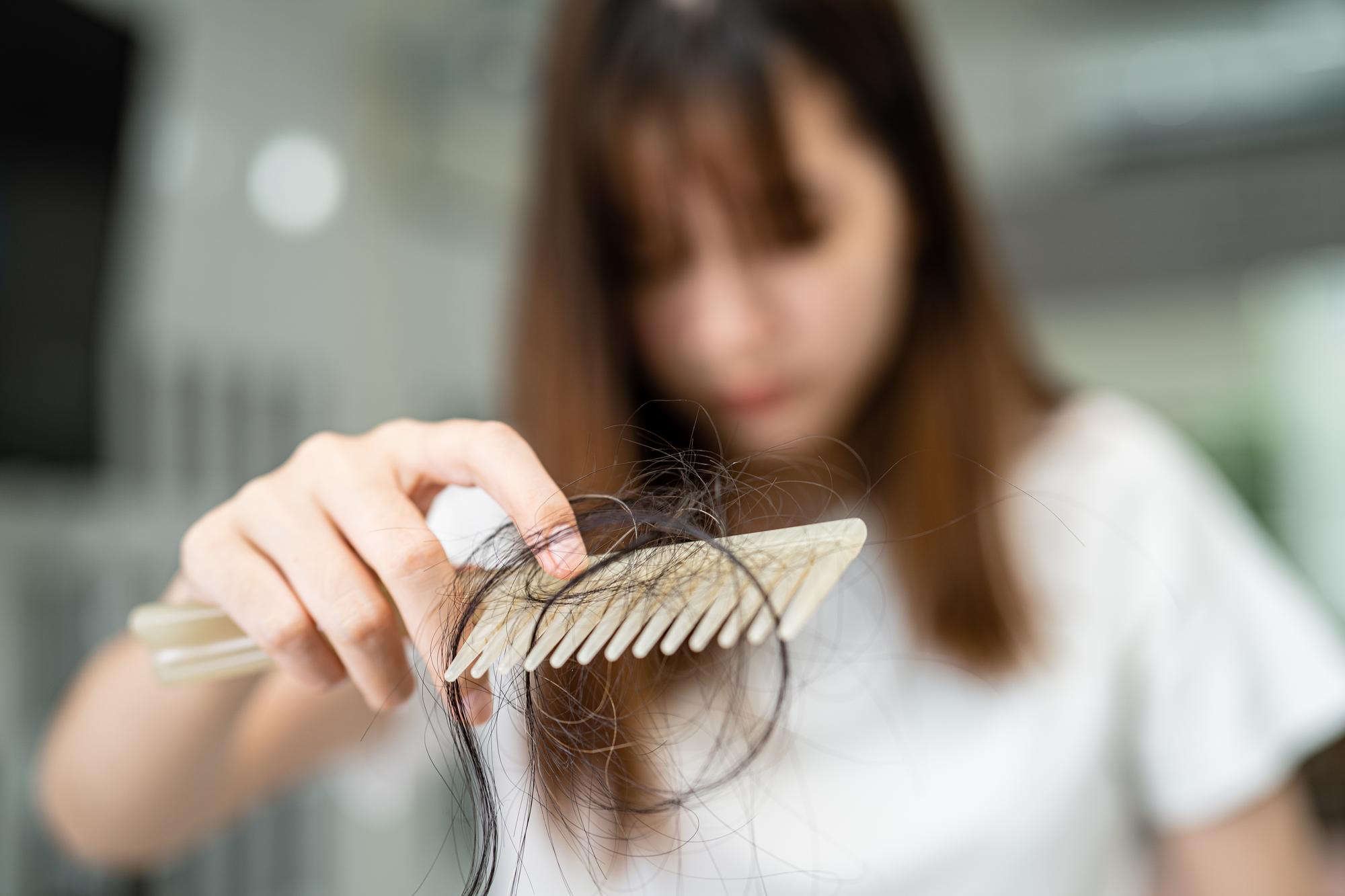 How Hair Loss in Women Differs from Men