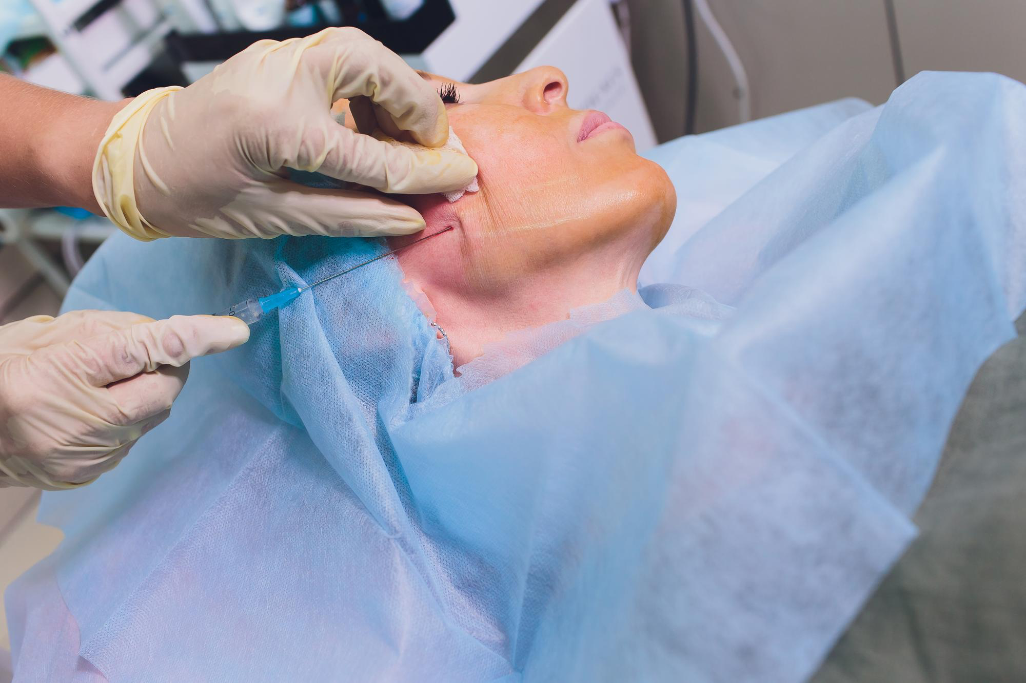 What to Expect After Your Subcision Procedure